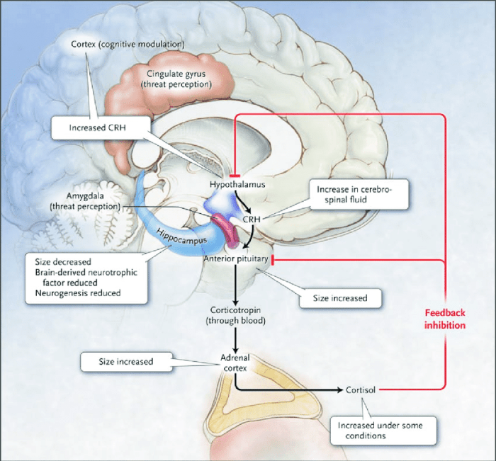 Brain parts involved in fight or flight response crossword